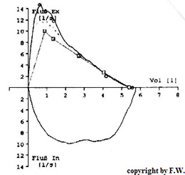 Spirometrie